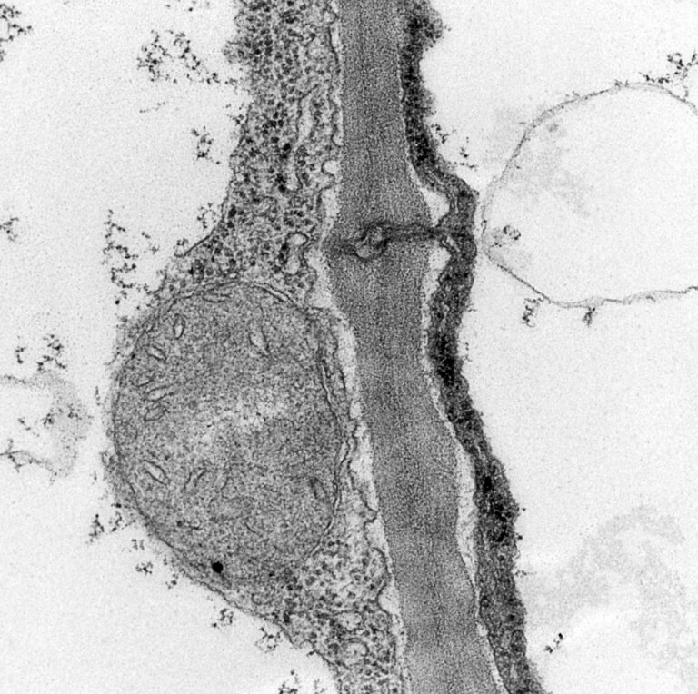 plant cell with plasomdesma