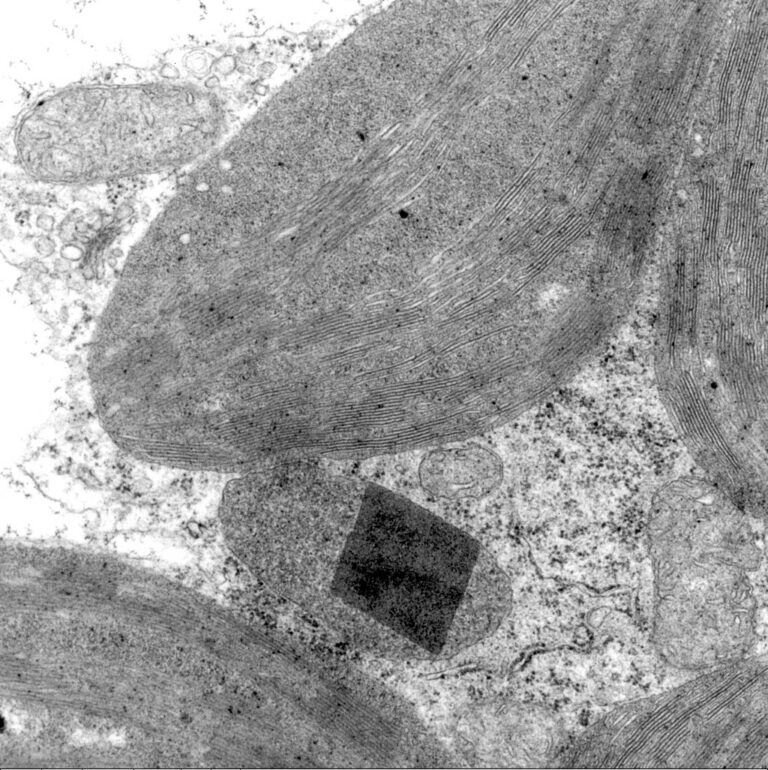 plant cell with peroxisome